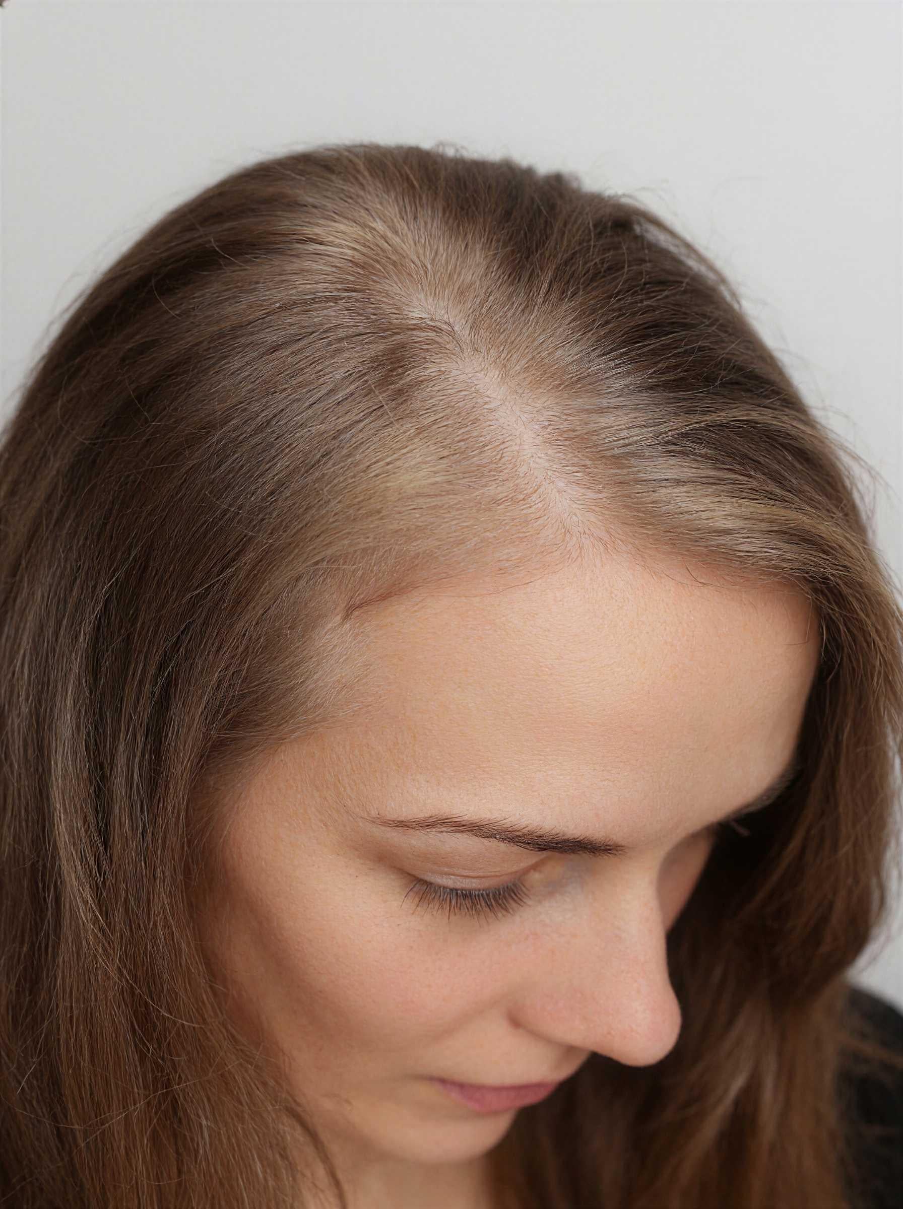 Détail cheveux Kératine Be Healthy