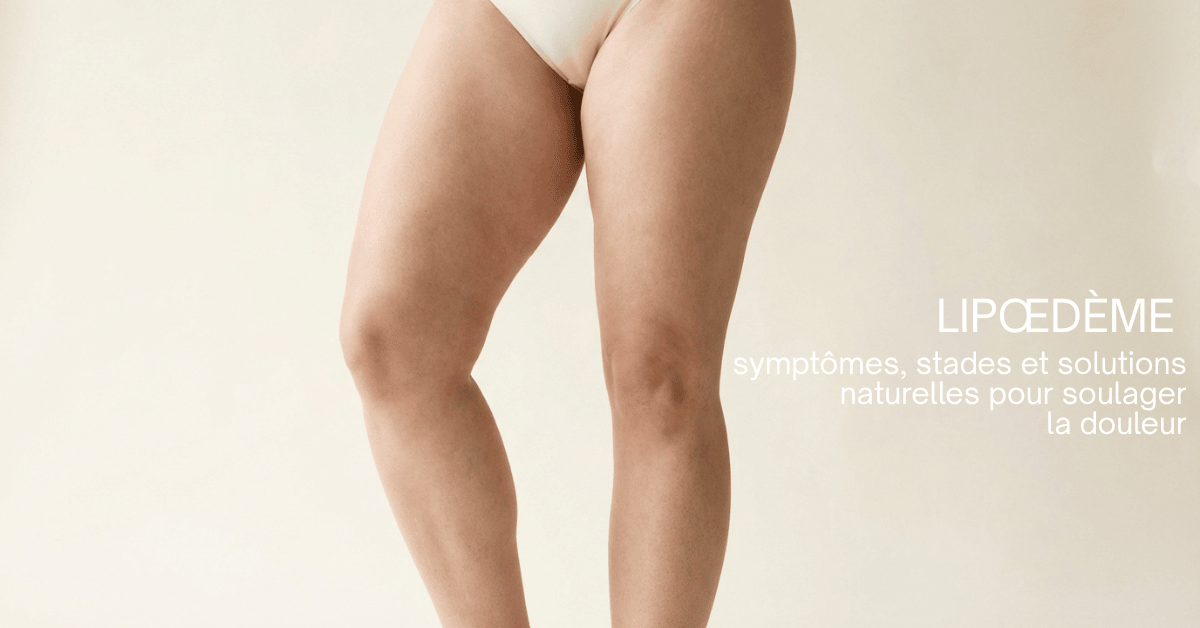 Femme souffrant de lipœdème aux jambes - traitement naturel et compléments alimentaires
