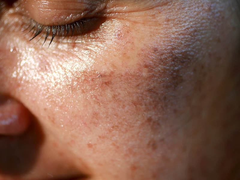 Indication particulière